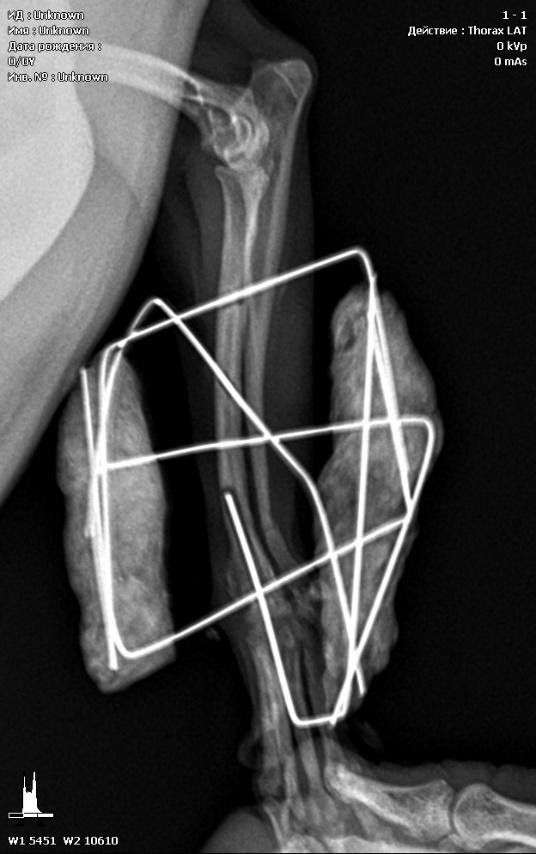 Дистальные переломы предплечья у карликовых пород  и методы их лечения.